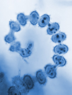 cleistothecium of Arthroderma spp dermatophytic fungus