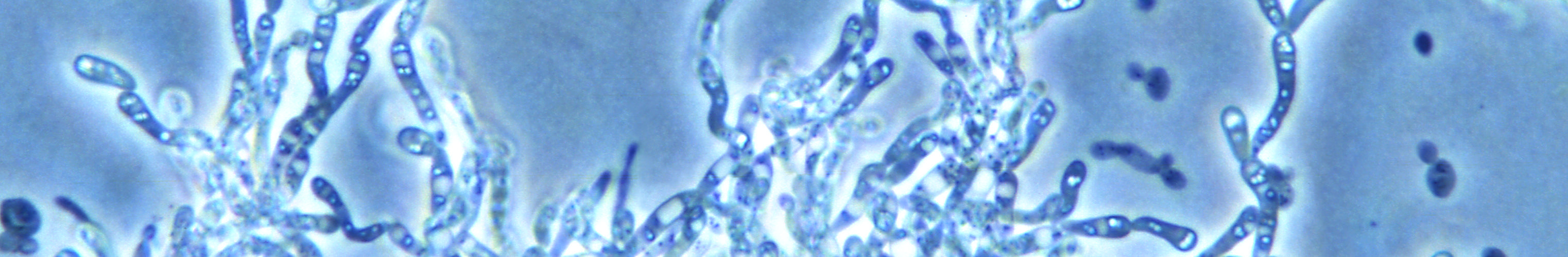 Saccharomyces filamentous pseudohyphae
