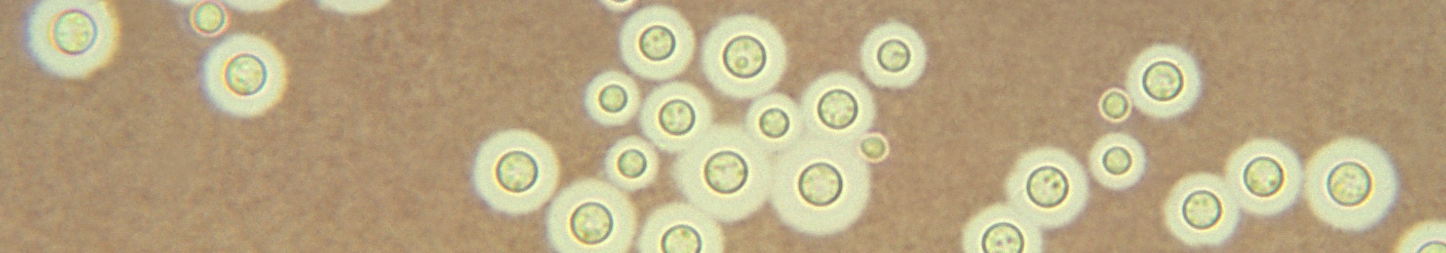 the encapsulated yeast Cryptococcus neoformans in india ink CDC Haley 1969